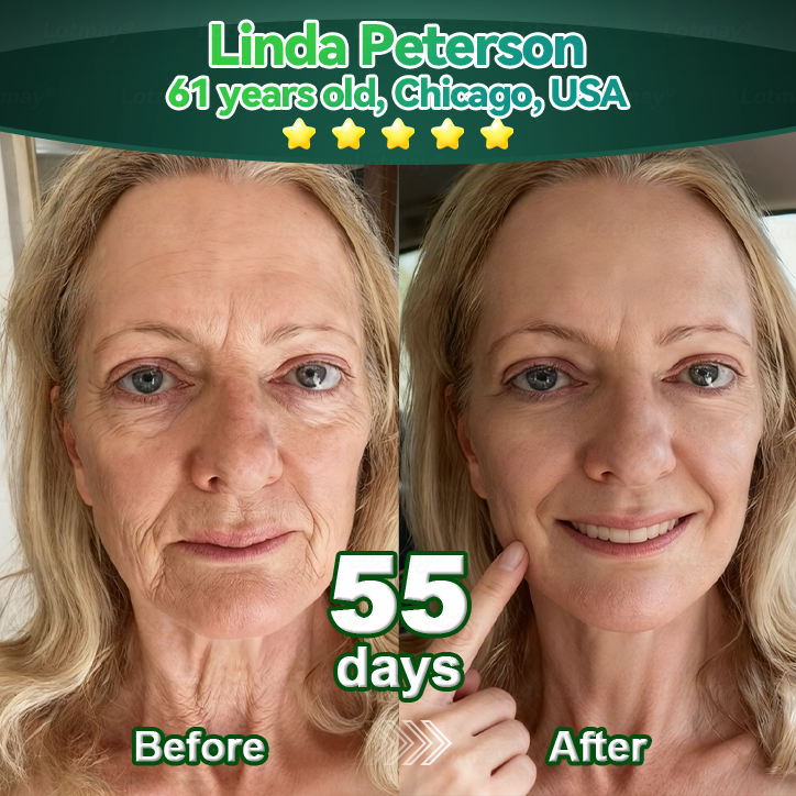 𝐎𝐟𝐟𝐢𝐳𝐢𝐞𝐥𝐥𝐞 𝐄𝐱𝐤𝐥𝐮𝐬𝐢𝐯𝐞 𝐀𝐮𝐟𝐥𝐚𝐠𝐞✅𝑇𝑟𝑖𝑙𝑢𝑚𝑖𝑎® 𝐾𝑜𝑙𝑙𝑎𝑔𝑒𝑛-𝑆𝑡𝑎𝑚𝑚𝑧𝑒𝑙𝑙-𝑉𝑒𝑟𝑗ü𝑛𝑔𝑢𝑛𝑔𝑠𝑠𝑒𝑟𝑢𝑚(𝐒𝐭𝐫𝐚𝐟𝐟𝐞𝐧 & 𝐅𝐚𝐥𝐭𝐞𝐧 𝐫𝐞𝐝𝐮𝐳𝐢𝐞𝐫𝐞𝐧🔴)