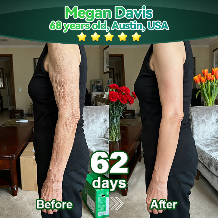𝐎𝐟𝐟𝐢𝐳𝐢𝐞𝐥𝐥𝐞 𝐄𝐱𝐤𝐥𝐮𝐬𝐢𝐯𝐞 𝐀𝐮𝐟𝐥𝐚𝐠𝐞✅𝑇𝑟𝑖𝑙𝑢𝑚𝑖𝑎® 𝐾𝑜𝑙𝑙𝑎𝑔𝑒𝑛-𝑆𝑡𝑎𝑚𝑚𝑧𝑒𝑙𝑙-𝑉𝑒𝑟𝑗ü𝑛𝑔𝑢𝑛𝑔𝑠𝑠𝑒𝑟𝑢𝑚(𝐒𝐭𝐫𝐚𝐟𝐟𝐞𝐧 & 𝐅𝐚𝐥𝐭𝐞𝐧 𝐫𝐞𝐝𝐮𝐳𝐢𝐞𝐫𝐞𝐧🔴)