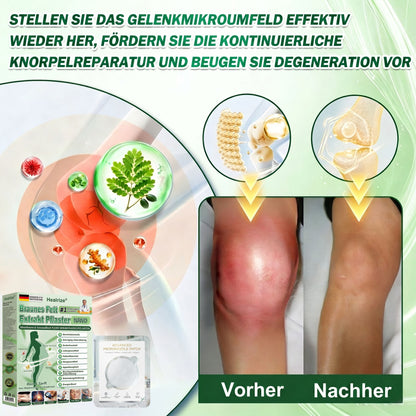 𝑶𝒇𝒇𝒊𝒛𝒊𝒆𝒍𝒆𝒓 𝑺𝒉𝒐𝒑 | ✨𝐇𝐞𝐚𝐥𝐫𝐢𝐳𝐞® Braunes Fett-Extrakt-Nanomikronadel-Patch (𝙀𝙞𝙣𝙢𝙖𝙡 𝙚𝙞𝙣𝙢𝙖𝙡 𝙩𝙖𝙜 𝙖𝙢 𝙏𝙖𝙜, 𝙨𝙞𝙘𝙝𝙩𝙚 𝙑𝙚𝙧𝙖𝙣𝙙𝙚𝙧𝙪𝙣𝙜𝙚𝙣 𝙣𝙖𝙘𝙝 7 𝙏𝙖𝙜𝙚𝙣)🐦‍🔥12-01